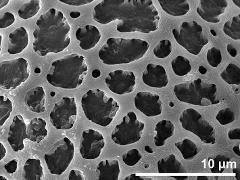exine surface