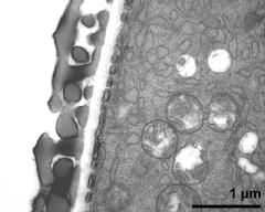 interapertural area of pollen wall