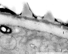 apertural area of pollen wall, intine (I), endexine (E)