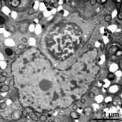 generative cell (top) and vegetative nucleus (bottom)