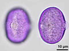 hydrated pollen,equatorial view