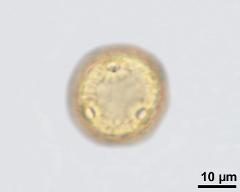 acetolysed pollen, lower focus