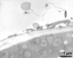 pollen wall at transition of aperture and interapertural area