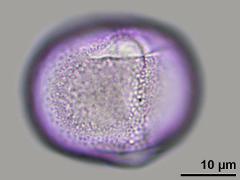 hydrated pollen,equatorial view