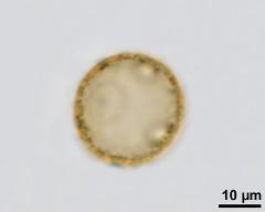 acetolysed pollen, optical section