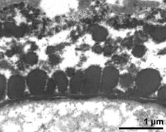 pollen wall of mature pollen grain