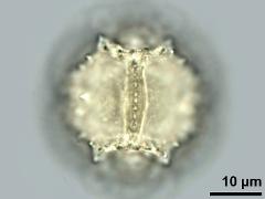 hydrated pollen,equatorial view