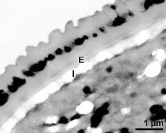 interapertural area of pollen wall