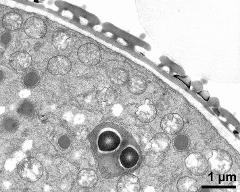 pollen wall at transition of aperture and interapertural area