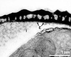 pollen wall at transition of aperture and interapertural area