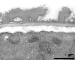 interapertural area of pollen wall