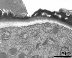 pollen wall at transition of aperture and interapertural area