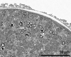 pollen wall at transition of aperture and interapertural area