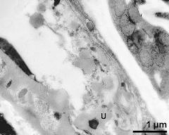 pollen wall (left) and tapetum cells with Ubisch bodies (U)