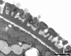 pollen wall, interapertural area, primexine matrix, pollenkitt