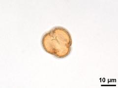 polar view,acetolyzed pollen