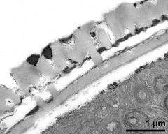 pollen wall, interapertural area