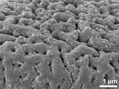 Sculpture in interapertural area