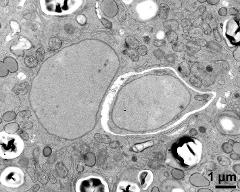  generative cell (right) and organells