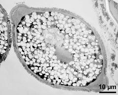 pollen grain in cross section