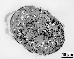 pollen grain in cross section