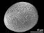 distal polar view