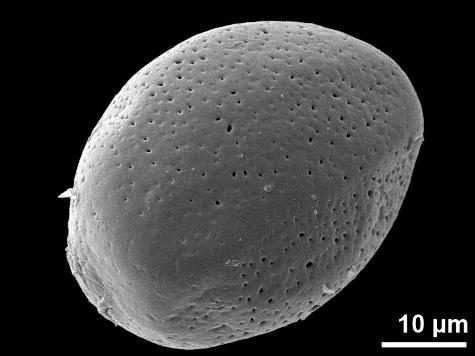 proximal polar view
