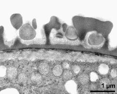 pollen wall; interapertural area