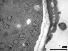 pollen wall, transition from aperture to interapertural area