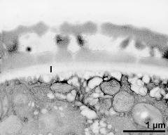 interapertural area of pollen wall