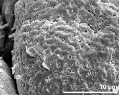 exine surface of hydrated tetrad