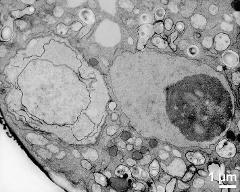 generative cell (left) and vegetative nucleus (right)