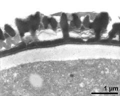 pollen wall, interapertural area, endexine clearly visible