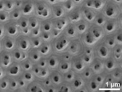 acetolyzed pollen,exine surface