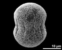 dry pollen grain in equatorial view