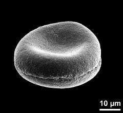 dry pollen grain