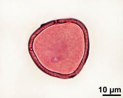 pollen grain with generative cell (asterisk)