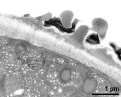 pollen wall at transition of aperture and interapertural region