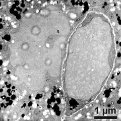 generative cell (right) and vegetative nucleus (left)