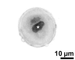 pollen grain with generative cell (asterisk) and vegetative nucleus