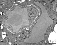 generative cell (left) and vegetative nucleus