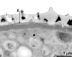 interapertural area of pollen wall, intine (I), endexine (E)