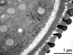 pollen wall, interapertural area,pollenkitt attached to pollen wall