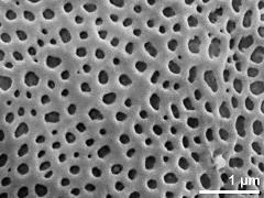 exine surface