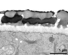 interapertural area of pollen wall