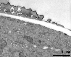 pollen wall at transition of aperture and interapertural area