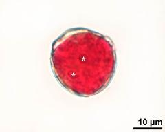 pollen grain with sperm cells (asterisks)