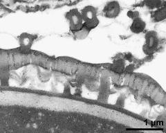 pollen wall in interapertural area,Ubisch bodies attached to pollen wall