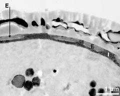 interapertural area of pollen wall, intine (I), endexine (E)