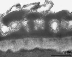 interapertural area of pollen wall